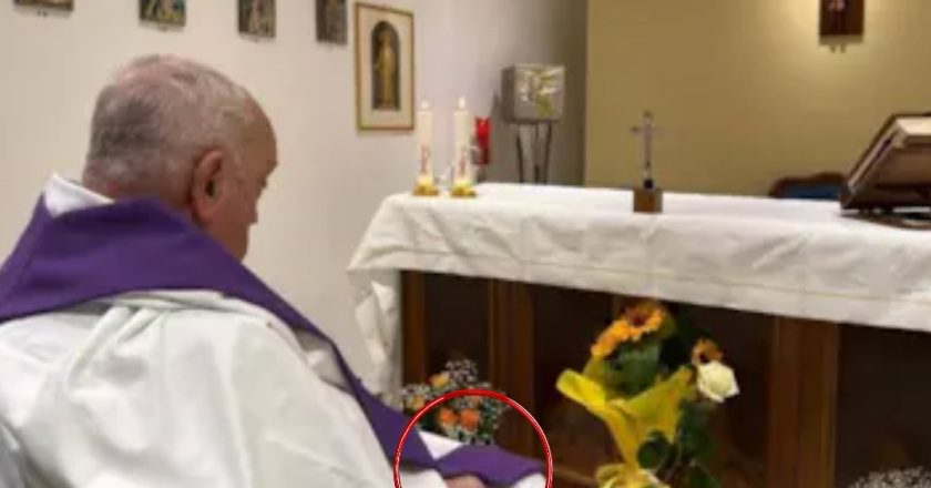 Papa Francesco, le sue condizioni: i medici svelano il motivo del gonfiore alla mano