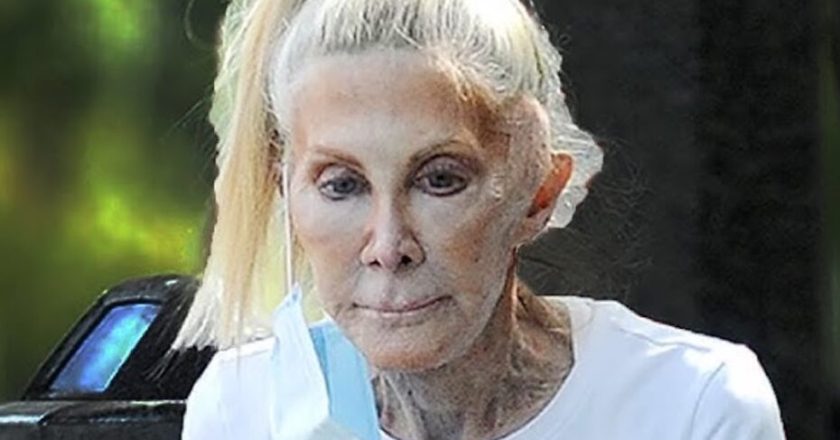 “Irriconoscibile”. Tutta rifatta, fan scioccati davanti alla famosa della tv