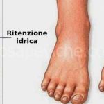 Ritenzione idrica: le cose da evitare per non avere pesantezza e gonfiore.