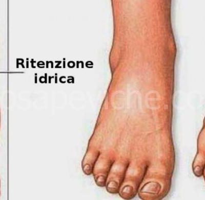 Ritenzione idrica: le cose da evitare per non avere pesantezza e gonfiore.