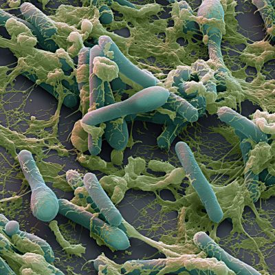 Botulino killer, i sintomi dell’intossicazione e quali sono gli alimenti a rischio