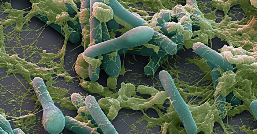 Botulino killer, i sintomi dell’intossicazione e quali sono gli alimenti a rischio