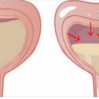 Il numero di volte che fai pipì indica se sei sano. Ecco tutto quello che devi sapere.