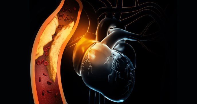 7 segnali che indicano le arterie ostruite. I sintomi da non sottovalutare mai