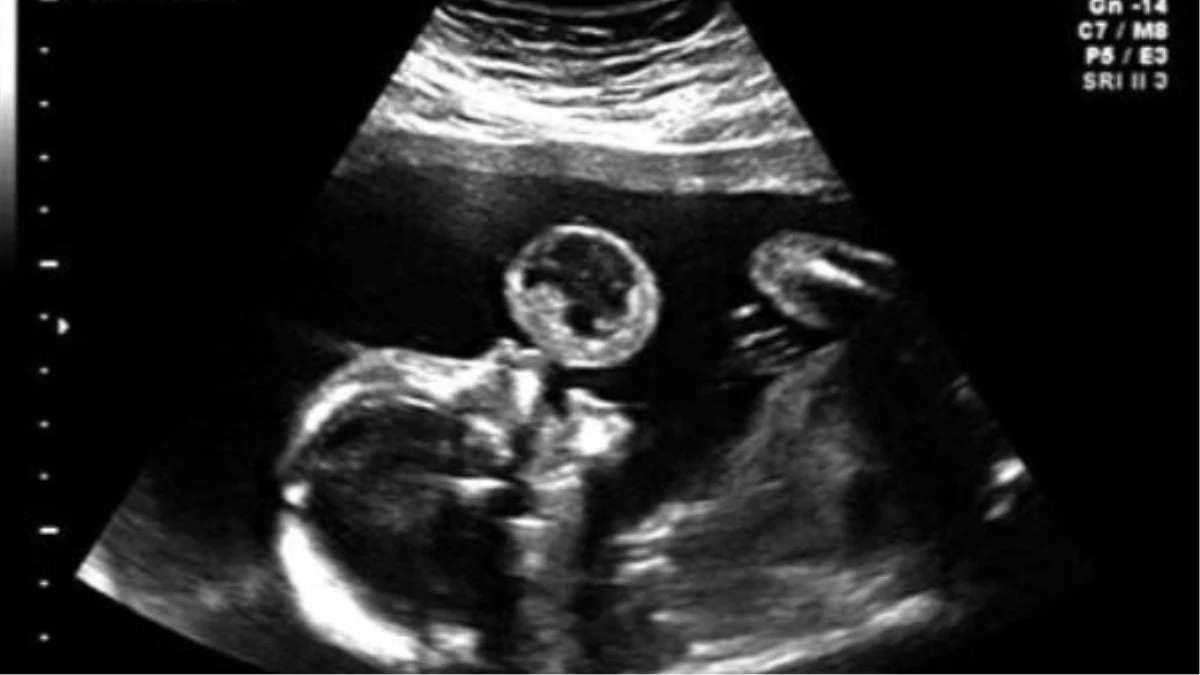 Articolo-copertina-Zap-1