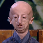 “Vivere a cento”: la canzone per i 30 anni di Sammy Basso commuove l’Italia