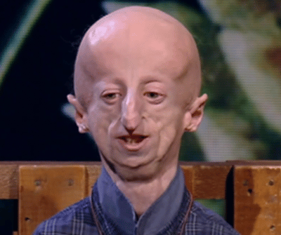 “Vivere a cento”: la canzone per i 30 anni di Sammy Basso commuove l’Italia