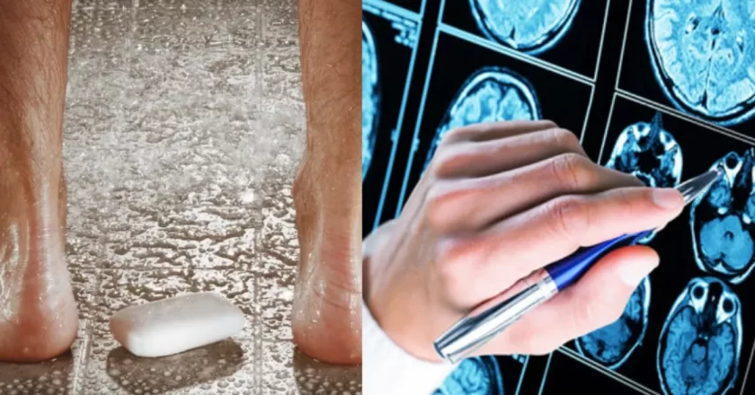 Alzheimer, il primo sintomo si manifesta durante la doccia: il segnale che quasi nessuno riconosce