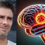 Di Battista, cosa indica un mal di testa forte e improvviso: l’analisi del neurologo Barbanti sulla cefalea a rombo di tuono