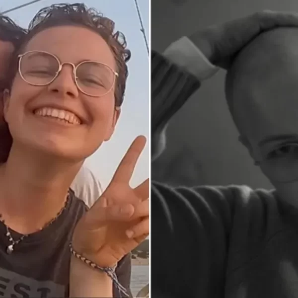Teresa Cherubini, la figlia di Jovanotti racconta la sua battaglia vinta contro il linfoma di Hodgkin
