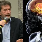 Morbo di Parkinson, cos’è il trascinamento dei piedi di cui ha parlato Dario Franceschini: sintomi iniziali e cause